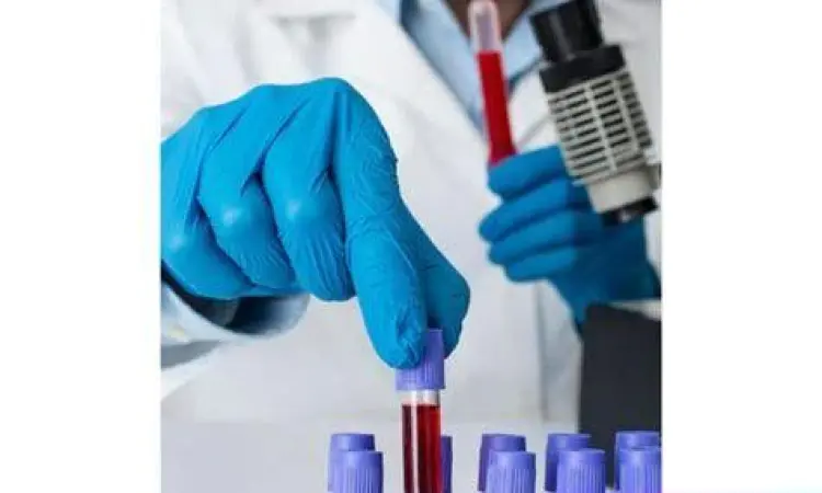 Pemeriksaan Laboratorium Petugas medis melakukan pengambilan sampel darah karyawan