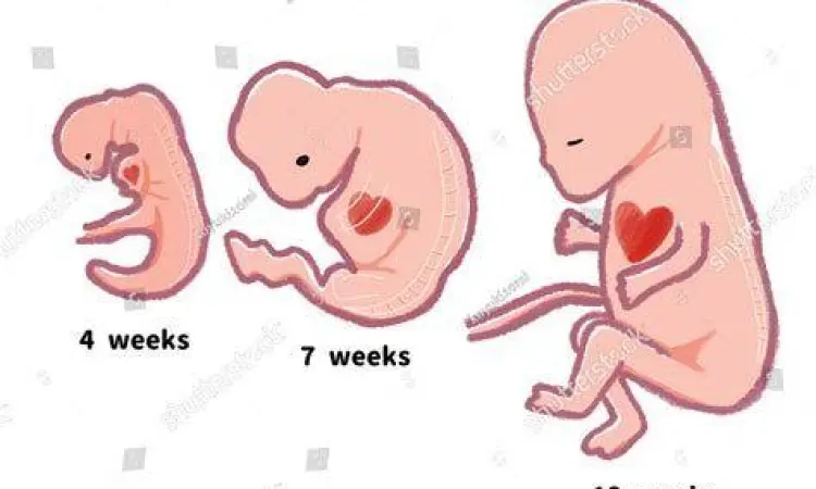 Sistem Kanban Toyota Visualisasi sistem kanban dalam produksi otomotif